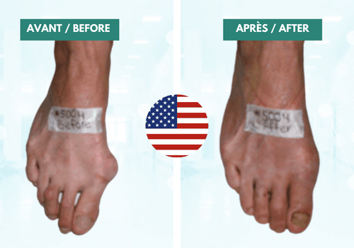 dr peter galati img a podiatrist fort lauderdale florida 1-2